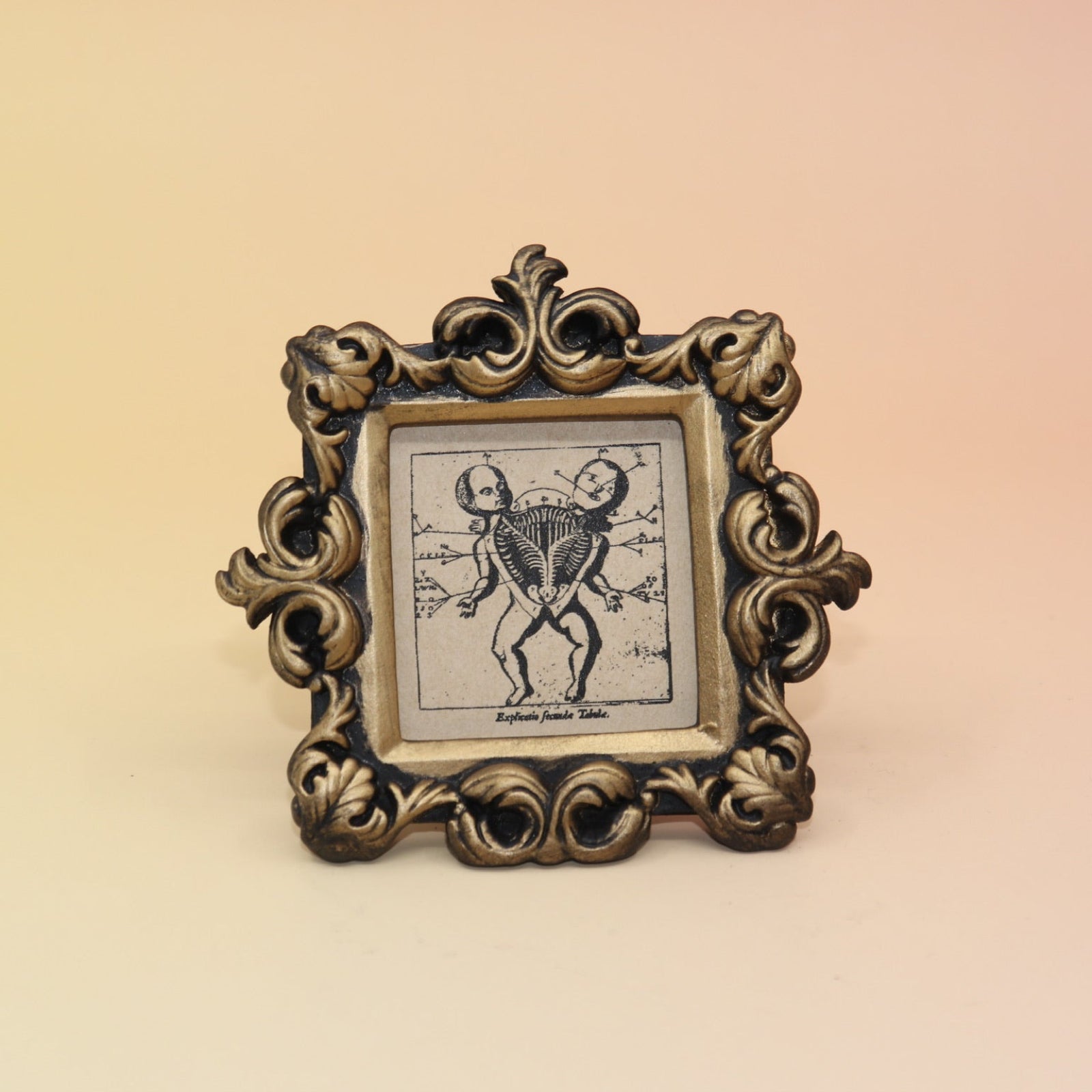 The Conjoined Twin Diagram Mini Vintage Framed Print on a pink and yellow background.